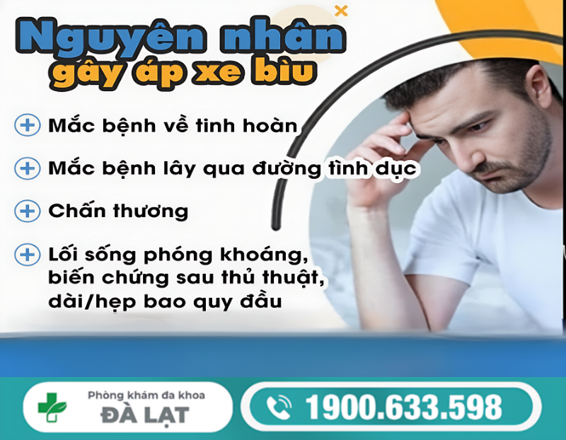 Hình ảnh minh họa